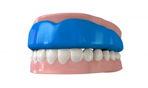 Mouth sports guard